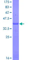 SDS-PAGE - Recombinant Human IL-4 Receptor alpha protein (GST tag N-Terminus) (AB158758)