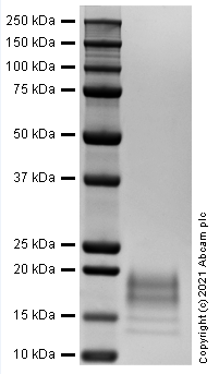 Recombinant Human IL-5 protein (Active)