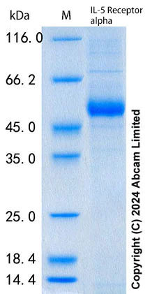 SDS-PAGE - Recombinant Human IL-5 Receptor alpha Protein Standard (His tag) (AB316723)