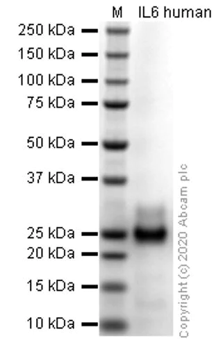 SDS-PAGE - Recombinant human IL-6 protein (Active) (AB259381)