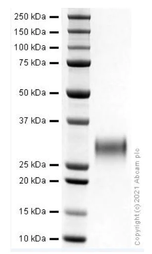 SDS-PAGE - Recombinant Human IL-7 protein (Tagged) (AB279974)