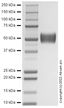 SDS-PAGE - Recombinant Human IL1R1 Protein (Active) (AB290103)