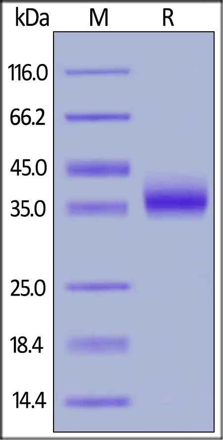 SDS-PAGE - Recombinant human IL2 Receptor beta/p75 protein (Active) (AB174003), expandable thumbnail