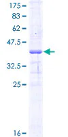 SDS-PAGE - Recombinant Human IL28RA protein (GST tag N-Terminus) (AB165762)