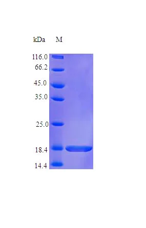 SDS-PAGE - Recombinant human IL36 gamma/IL-1F9 protein (Active) (AB243948)