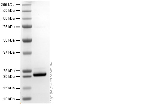 SDS-PAGE - Recombinant human IL36 gamma/IL-1F9 protein (His Tag) (AB318252), expandable thumbnail