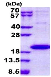 SDS-PAGE - Recombinant Human IL36 gamma/IL-1F9 protein (His tag N-Terminus) (AB167874)