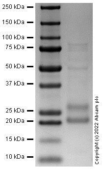 SDS-PAGE - Recombinant Human IL37 protein (AB287926)