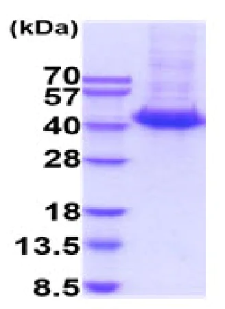 SDS-PAGE - Recombinant Human IL3RA/CD123 protein (His tag) (AB227400)