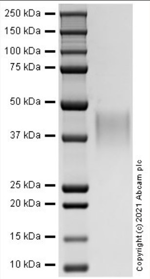 SDS-PAGE - Recombinant Human IL7RA Protein (AB287915), expandable thumbnail