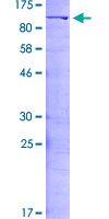 Recombinant Human ILF3 protein