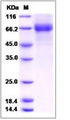 SDS-PAGE - Recombinant Human ILT-4 protein (His tag) (AB276614)