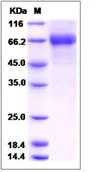 SDS-PAGE - Recombinant Human ILT-4 protein (His tag) (AB276614)