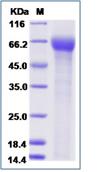 SDS-PAGE - Recombinant Human ILT-7 protein (His tag) (AB276712), expandable thumbnail