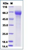 SDS-PAGE - Recombinant Human ILT-7 protein (His tag) (AB276712)