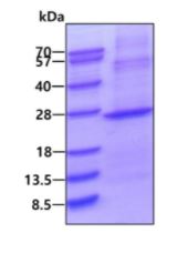 SDS-PAGE - Recombinant Human IMP3 protein (denatured) (His tag N-Terminus) (AB139801)