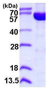 SDS-PAGE - Recombinant Human IMPDH2 protein (His tag N-Terminus) (AB113608)