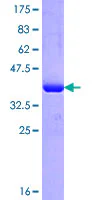 SDS-PAGE - Recombinant Human IMPG2 protein (GST tag N-Terminus) (AB162379)
