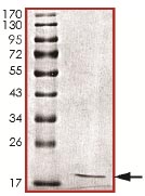 Recombinant Human INCENP protein