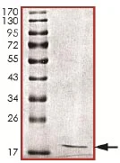 SDS-PAGE - Recombinant Human INCENP protein (His tag N-Terminus) (AB135223)