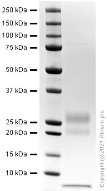 SDS-PAGE - Recombinant Human Inhibin alpha protein (AB280388)