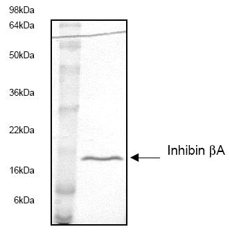 SDS-PAGE - Recombinant Human Inhibin beta A protein (AB53506)