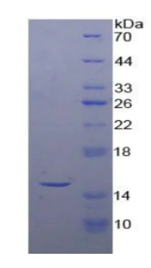 SDS-PAGE - Recombinant Human Inhibin beta A protein (His tag) (AB275793)