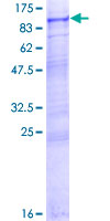 Recombinant Human INPP5E protein