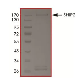 SDS-PAGE - Recombinant human INPPL1/SHIP-2 protein (Active) (AB268968)