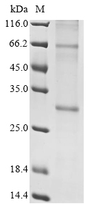 SDS-PAGE - Recombinant Human Insig2 protein (AB289767), expandable thumbnail