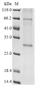 SDS-PAGE - Recombinant Human Insig2 protein (AB289767)