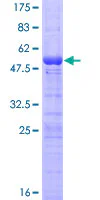SDS-PAGE - Recombinant Human INSL4 protein (GST tag N-Terminus) (AB132848)
