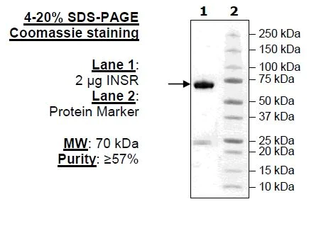 SDS-PAGE - Recombinant human Insulin Receptor protein (AB80251)