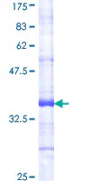 SDS-PAGE - Recombinant Human Insulin Receptor protein (GST tag N-Terminus) (AB158767)