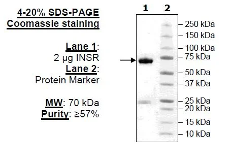 SDS-PAGE - Recombinant human Insulin Receptor protein (GST tag N-Terminus) (AB80251)