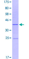 SDS-PAGE - Recombinant Human Integrin alpha 2 protein (GST tag N-Terminus) (AB158772)