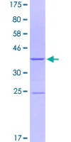 SDS-PAGE - Recombinant Human Integrin alpha 2 protein (AB158772)