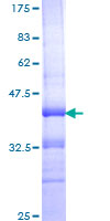 Recombinant Human Integrin alpha 4/CD49D protein