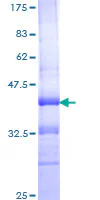 SDS-PAGE - Recombinant Human Integrin alpha 4/CD49D protein (GST tag N-Terminus) (AB158773)