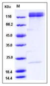 SDS-PAGE - Recombinant Human Integrin alpha 5 + beta 1 protein (Tagged) (AB277027)