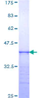 SDS-PAGE - Recombinant Human Integrin alpha 6 protein (AB158769)