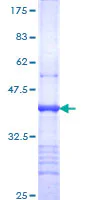 SDS-PAGE - Recombinant Human Integrin alpha 9 protein (GST tag N-Terminus) (AB158774)