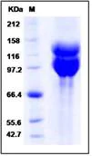 SDS-PAGE - Recombinant Human Integrin alpha V + ITGB6 protein (Tagged) (AB277032)