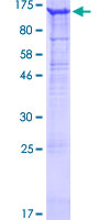SDS-PAGE - Recombinant Human Integrin alpha V protein (GST tag N-Terminus) (AB114240)