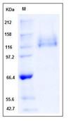 SDS-PAGE - Recombinant Human Integrin beta 1 + Integrin alpha 6 protein (Tagged) (AB277026)
