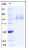 SDS-PAGE - Recombinant Human Integrin beta 1 + Integrin alpha 6 protein (Tagged) (AB277026)