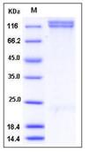 SDS-PAGE - Recombinant Human Integrin beta 1 + ITGA8 protein (Tagged) (AB277028)