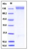 SDS-PAGE - Recombinant Human Integrin beta 1 + ITGA8 protein (Tagged) (AB277028)