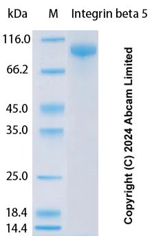 SDS-PAGE - Recombinant Human Integrin beta 5 Protein Standard (His tag) (AB323153)