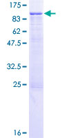Recombinant Human Integrin beta 7 protein